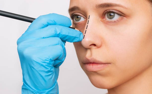 Un traumatisme nasal peut avoir plusieurs origines. En effet, un accident, une chute ou un coup violent peuvent le provoquer.