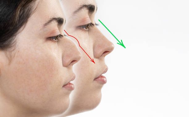 La forme du nez n’est pas qu’une question d’esthétique. En réalité, elle joue un rôle fonctionnel majeur. En effet, la structure