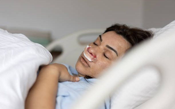 Tout d’abord, il est essentiel de distinguer les types de rhinoplastie. En effet, on parle souvent de chirurgie esthétique.